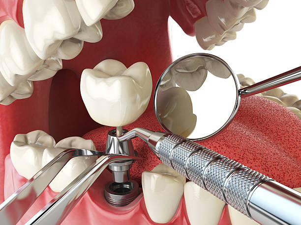 Best Emergency Treatment for Jaw Pain or Injury in Granville South, OH